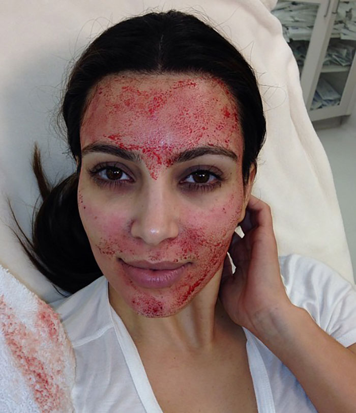 3 Women Test Positive For HIV After Getting Spa Treatment Promoted By Kim Kardashian