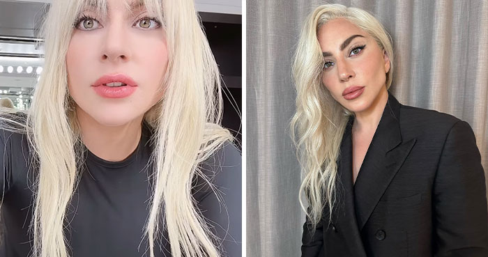“WHERE ARE YOUR ETHICS?”: Lady Gaga Slammed For Promoting Migraine Med