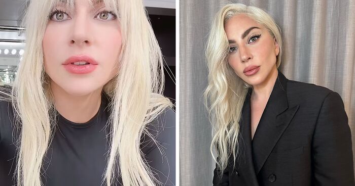 “WHERE ARE YOUR ETHICS?”: Lady Gaga Slammed For Promoting Migraine Med
