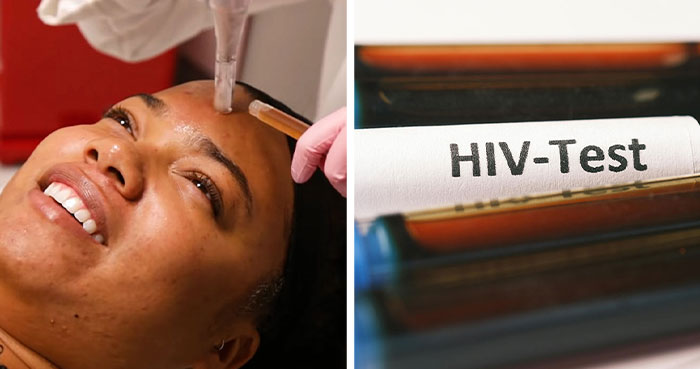 3 Women Infected With HIV From “Vampire Facial” Treatment Promoted By Kim Kardashian