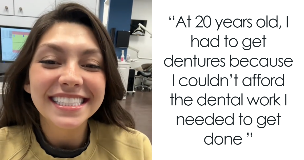After Having All Her Teeth Pulled Out At 20, Woman Shares “Before/After” Implants Transformation