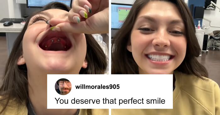 Woman’s Journey To Get New Teeth After Hers Were Pulled Out At Age 20 Goes Viral