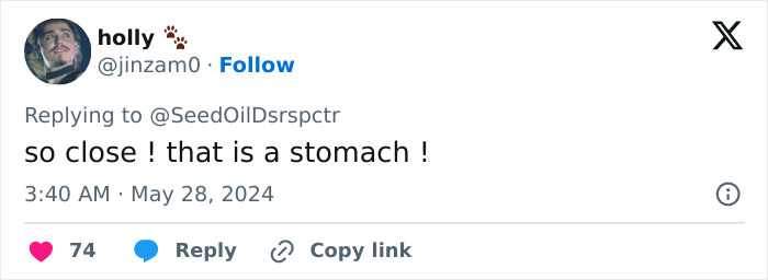 “There’s No Doubt About It”: OB-GYNs Weigh In On Taylor Swift Pregnancy Rumors “There’s No Doubt About It”: OB-GYNs Weigh In On Taylor Swift Pregnancy Rumors