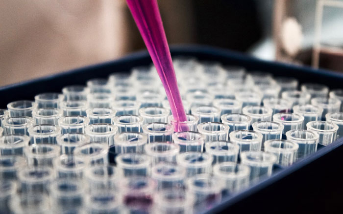 Teen Panics After DNA Results With Her Twin Sister Changed Everything She Knew About Herself Teen Panics After DNA Results With Her Twin Sister Changed Everything She Knew About Herself