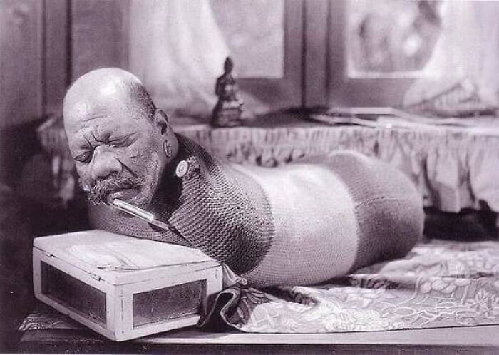 Prince Randian, Also Known As The Living Torso, Was A Performer In American Sideshows In The 1930s. Born In British Guyana In 1871, Randian Was Known As The "Human Caterpillar" For His Ability To Crawl On His Belly