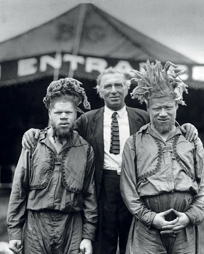 1899, Two African-American Brothers With Albinism Were Forcibly Exploited As Performers In A Circus. In 1927 They Returned To Roanoke And George Recognized Their Mother, And Screamed, "Willie, She Is Not Dead"!