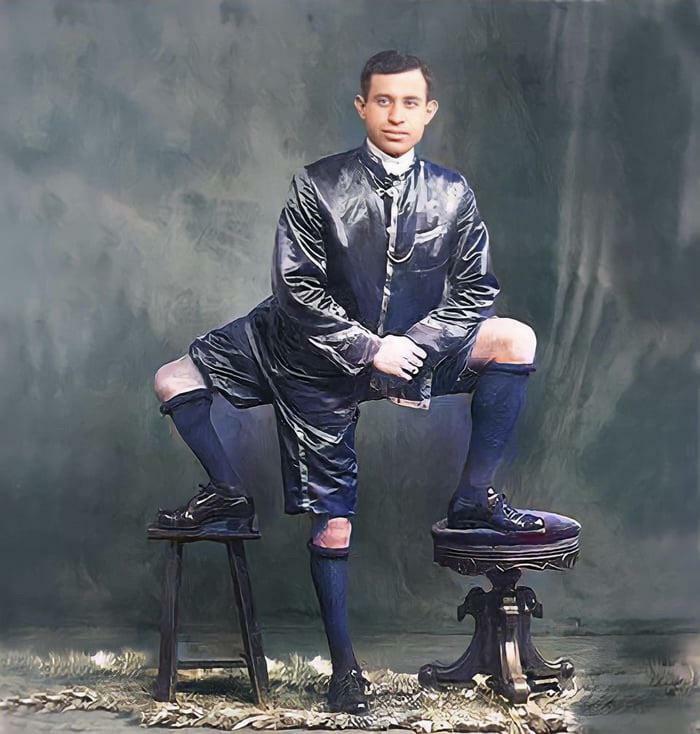 Francesco "Frank" Lentini (May 18, 1889 − September 21, 1966) Was A Sicilian-American Sideshow Performer. Born With A Parasitic Twin, Lentini Had Three Legs, Four Feet, And Two Sets Of Genitals