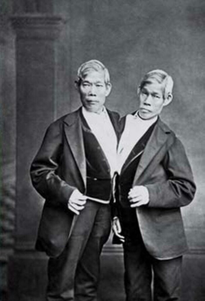 Chang And Eng Bunker Were A Pair Of Conjoined Twins Born In Siam (Now Thailand) In 1811. They Found Work As Freak Show Performers Across The World, And Both Got Married And Had Children In America. Chang And Eng Popularized The Term “Siamese Twins”