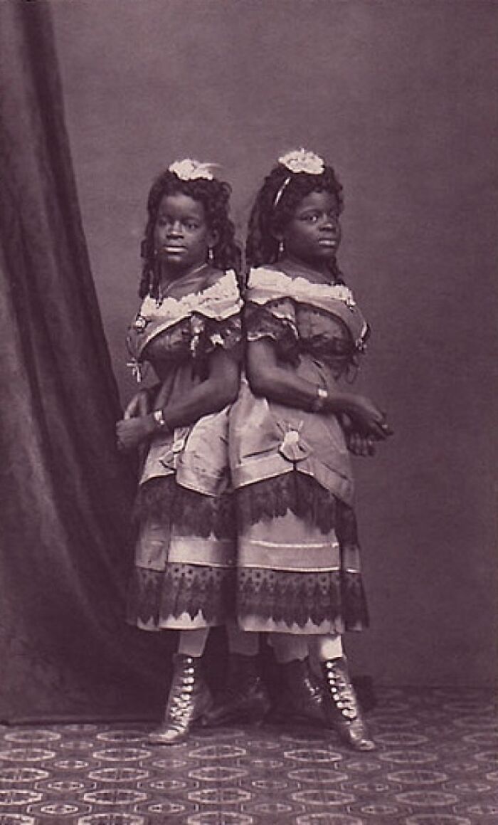 Millie And Christine Mckoy Were African-American Pygopagus Conjoined Twins. They Traveled Throughout The World Performing Song And Dance Shows