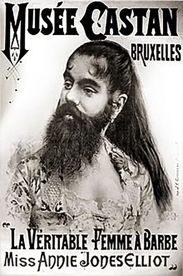 Annie Jones, A Bearded Woman Who Toured With P.t. Barnum As A Circus Attraction