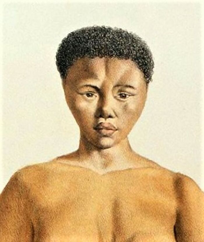 Saartjie "Sarah" Baartman (1789 – 29 December 1815) Was The Most Famous Of At Least Two Khoikhoi Women Who Were Exhibited As Sideshow Attractions In 19th Century Europe Under The Name Hottentot Venus