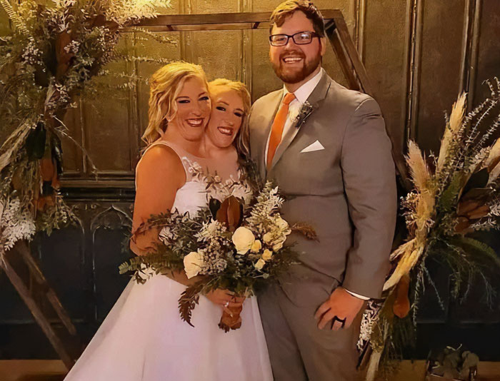 “Feels Like Someone Messing With Your Body”: Conjoined Twin Shares Intimate Lifestyle Details “Feels Like Someone Messing With Your Body”: Conjoined Twin Shares Intimate Lifestyle Details