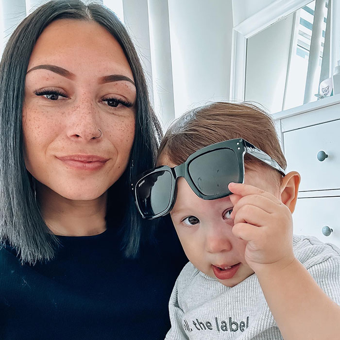 Trolls Called This Mom A “Monster” For Lasering Off Son’s Birthmark—Now She’s Making A Difference