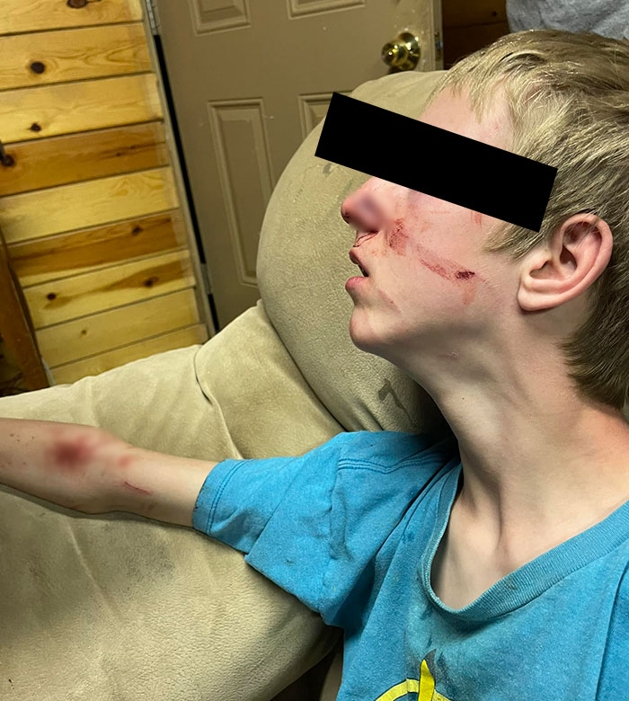 15-Year-Old Boy With Neurological Disorder Mauled By Bear While Watching TV 15-Year-Old Boy With Neurological Disorder Mauled By Bear While Watching TV
