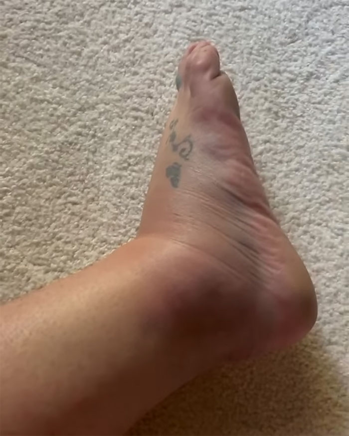 “I Felt Completely Harassed”: Britney Spears Slams Paramedics Amid Chateau Marmont Chaos “I Felt Completely Harassed”: Britney Spears Slams Paramedics Amid Chateau Marmont Chaos