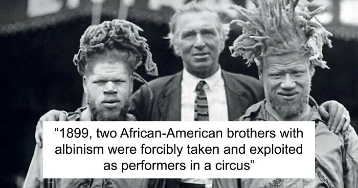 40 Incredible Pictures That Tell The Stories Of Retro Circus Performers