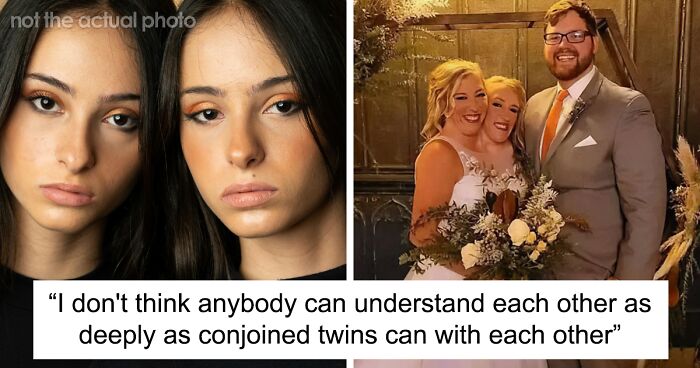 “I Had A Girlfriend, She Had A Boyfriend”: Conjoined Twin Shares Intimate Lifestyle Details