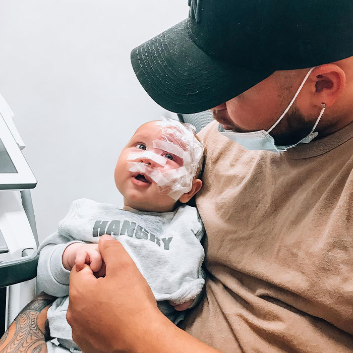 Trolls Called This Mom A “Monster” For Lasering Off Son’s Birthmark—Now She’s Making A Difference