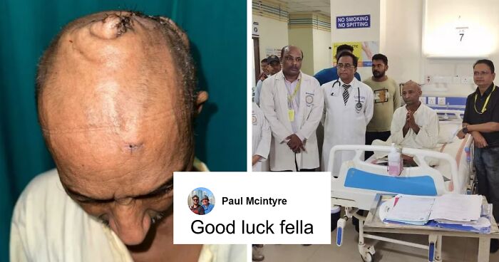 10-Hour Operation To Remove 15-Lb Tumor From Man’s Head Deemed “Medical Miracle”
