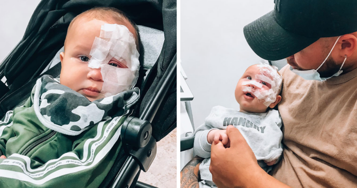 Trolls Called Her A “Monster” For Lasering Off Son’s Birthmark—Now She’s Making A Difference