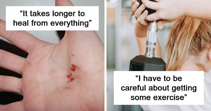 People Share 50 Physical Changes They Started Noticing Once They Turned 40