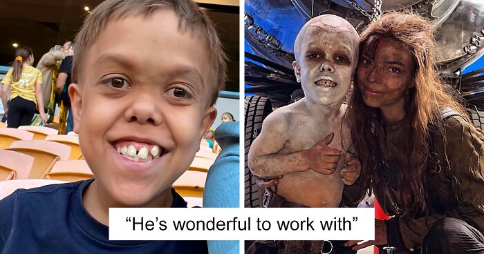 Bullied Boy With Dwarfism Becomes “Furiosa: A Mad Max Saga” Actor, Delights Viewers
