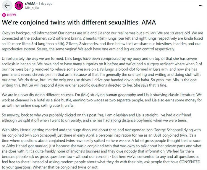 “Feels Like Someone Messing With Your Body”: Conjoined Twin Shares Intimate Lifestyle Details