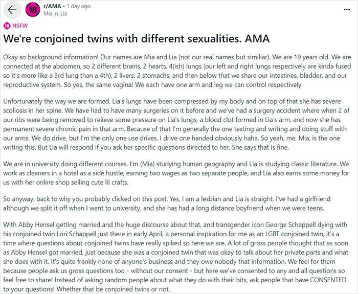 “Feels Like Someone Messing With Your Body”: Conjoined Twin Shares Intimate Lifestyle Details “Feels Like Someone Messing With Your Body”: Conjoined Twin Shares Intimate Lifestyle Details