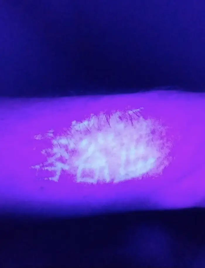 These Characters Appeared On My Arm Under A Blacklight
