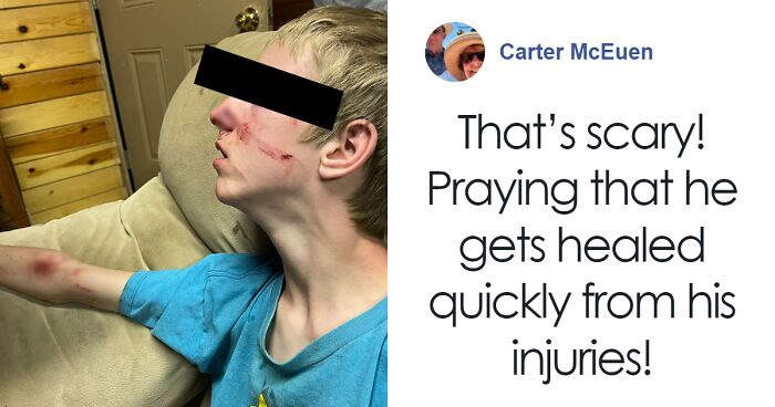 Boy, 15, Mauled By Bear That Sneaked Up On Him Inside Cabin While He Was Watching TV