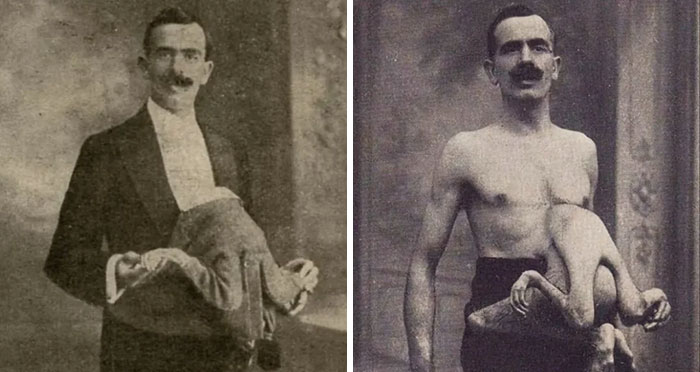 The Man With A Parasitic Twin Growing Out Of His Torso: The Life Of Circus Performer Jean Libbera