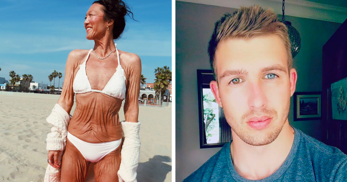 50 Photos Of People Who Drew Wild Cards In The Genetic Lottery (New Pics)