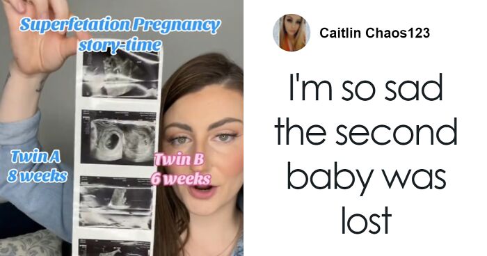 Woman Stuns Her Doctors By Getting Pregnant While Already Pregnant
