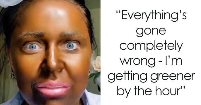 “Why On Earth Did You Use So Many?“: People Stunned After Woman’s Fake Tan Turns Green
