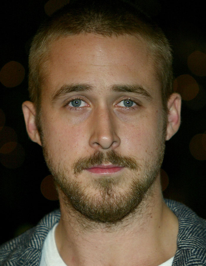 Close-up portrait of a man with a beard, related to injector discussions. Close-up portrait of a man with a beard, related to injector discussions.