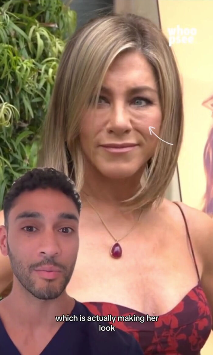 Doctor Explains What Is Making Jennifer Aniston’s Face Look “More Tired And Aged” Doctor Explains What Is Making Jennifer Aniston’s Face Look “More Tired And Aged”