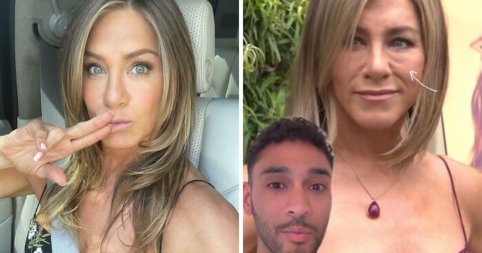 Doctor Explains What Is Making Jennifer Aniston’s Face Look “More Tired And Aged”