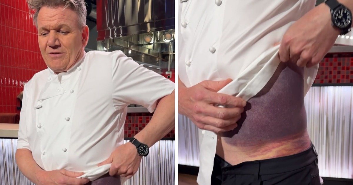 “I’m Lucky To Be Here”: Gordon Ramsay Flooded With Recovery Wishes ...