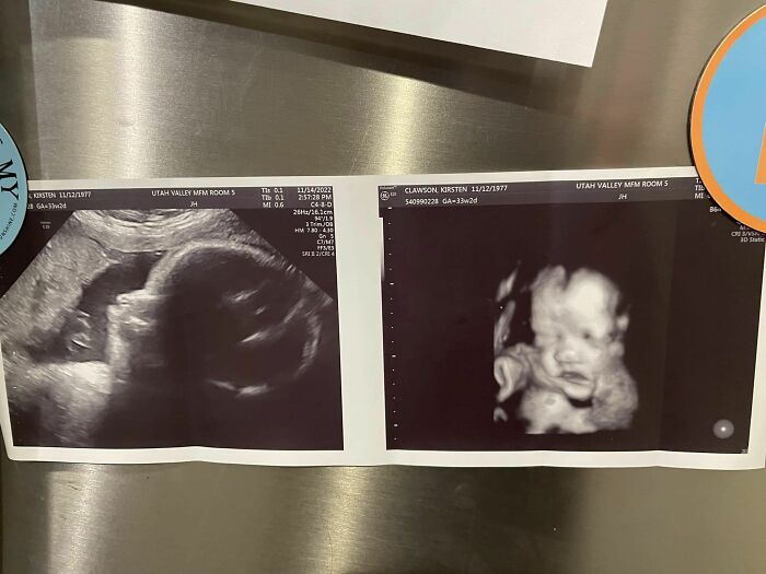 Couple Built A Loving Family Together While Allowing Each Other Space To Grieve Their Late Spouses Couple Built A Loving Family Together While Allowing Each Other Space To Grieve Their Late Spouses