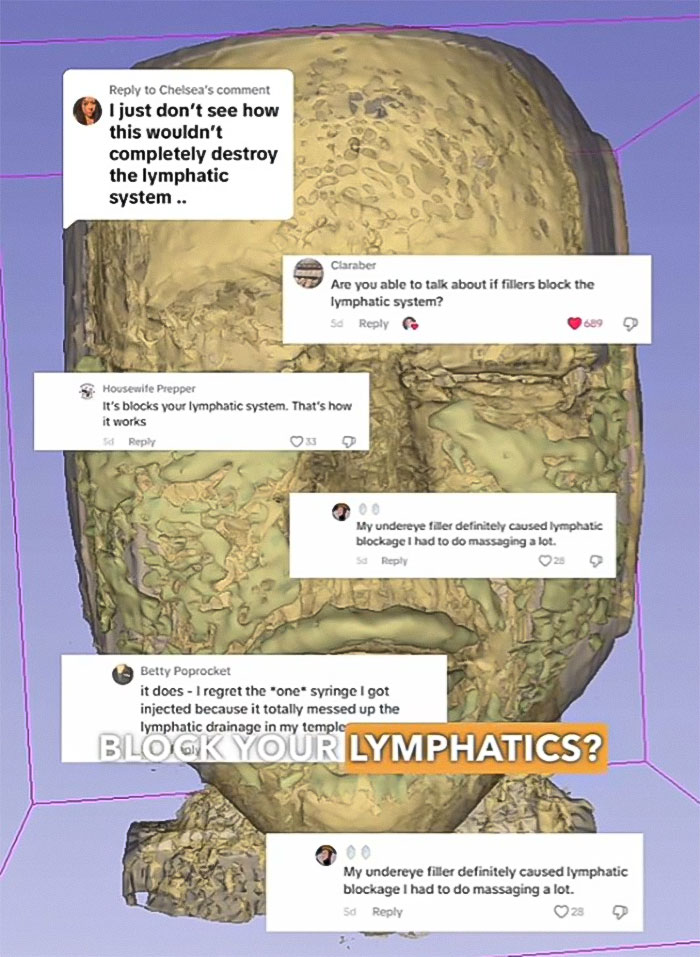 “Never Getting Fillers”: After MRI Of Woman Stuns Viewers, Doctor Discusses Effects “Never Getting Fillers”: After MRI Of Woman Stuns Viewers, Doctor Discusses Effects