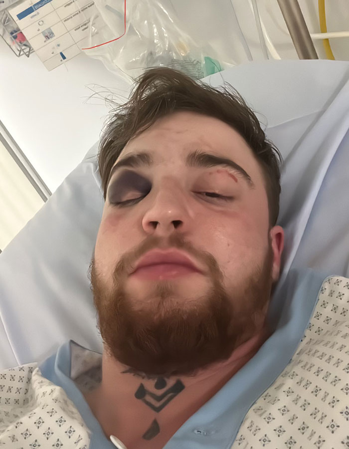 29-Year-Old Trans Man Gets Brutally Beaten Up In Switzerland, Claims It’s A Hate Crime 29-Year-Old Trans Man Gets Brutally Beaten Up In Switzerland, Claims It’s A Hate Crime