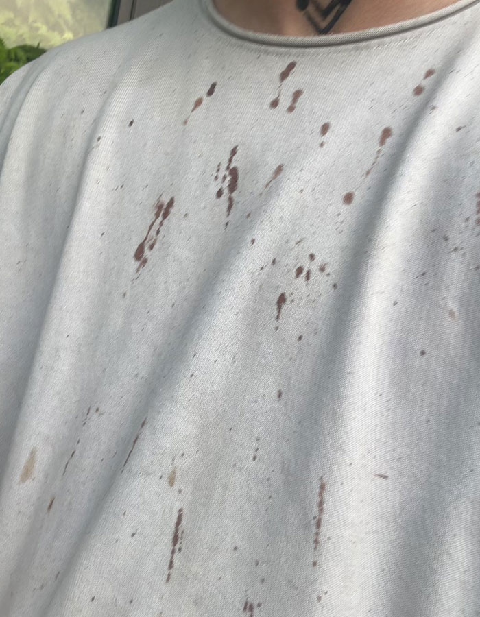 29-Year-Old Trans Man Gets Brutally Beaten Up In Switzerland, Claims It’s A Hate Crime 29-Year-Old Trans Man Gets Brutally Beaten Up In Switzerland, Claims It’s A Hate Crime