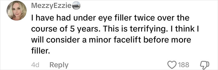 “Never Getting Fillers”: After MRI Of Woman Stuns Viewers, Doctor Discusses Effects “Never Getting Fillers”: After MRI Of Woman Stuns Viewers, Doctor Discusses Effects