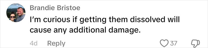 “Never Getting Fillers”: After MRI Of Woman Stuns Viewers, Doctor Discusses Effects “Never Getting Fillers”: After MRI Of Woman Stuns Viewers, Doctor Discusses Effects