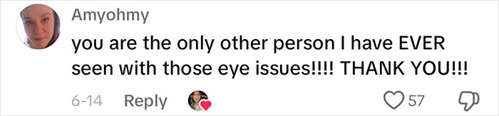 Woman Realizes She’s Been “Accidentally Poisoning” Herself For Months After Removing Earrings Woman Realizes She’s Been “Accidentally Poisoning” Herself For Months After Removing Earrings