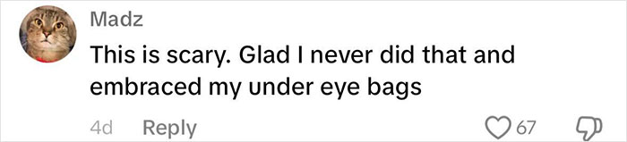 “Never Getting Fillers”: After MRI Of Woman Stuns Viewers, Doctor Discusses Effects “Never Getting Fillers”: After MRI Of Woman Stuns Viewers, Doctor Discusses Effects