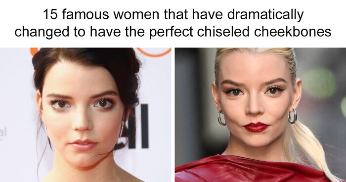 What 14 Famous Stars Looked Like Before Their Stunning Cheekbone Transformations