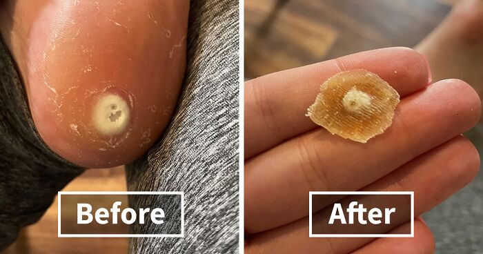 22 Embarrassing Products That Are Actually Amazing And Available Online (Phew!)