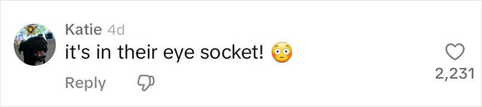 MRI Of 33-Year-Old Woman’s Face Reveals Where All Her Filler Went MRI Of 33-Year-Old Woman’s Face Reveals Where All Her Filler Went