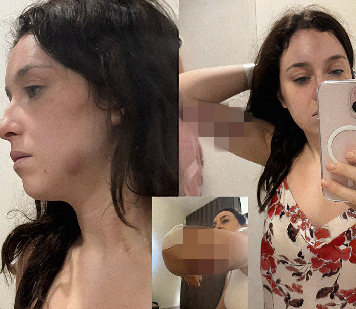 Flight Attendant Arrested In Dubai After Her Husband Attacked Her Flight Attendant Arrested In Dubai After Her Husband Attacked Her